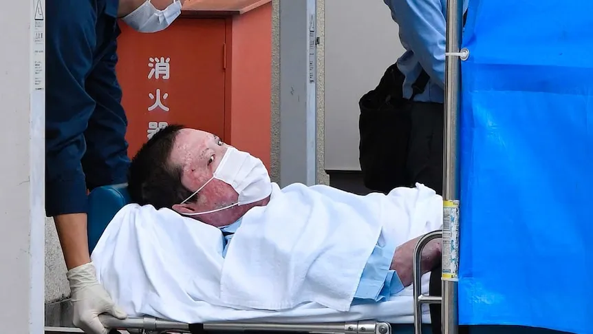 kondisi aoba setelah tragedi pembakaran studio kyoto animation